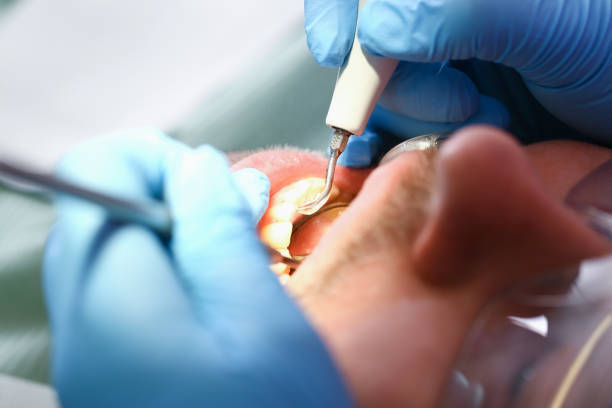 Best Emergency Broken Tooth Repair in Mount Zion, GA