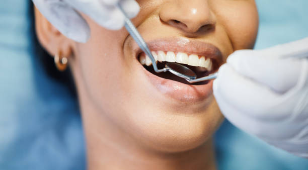 Best Emergency Wisdom Teeth Removal in Mount Zion, GA